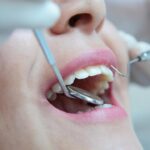 Preguntas frecuentes sobre una endodoncia.