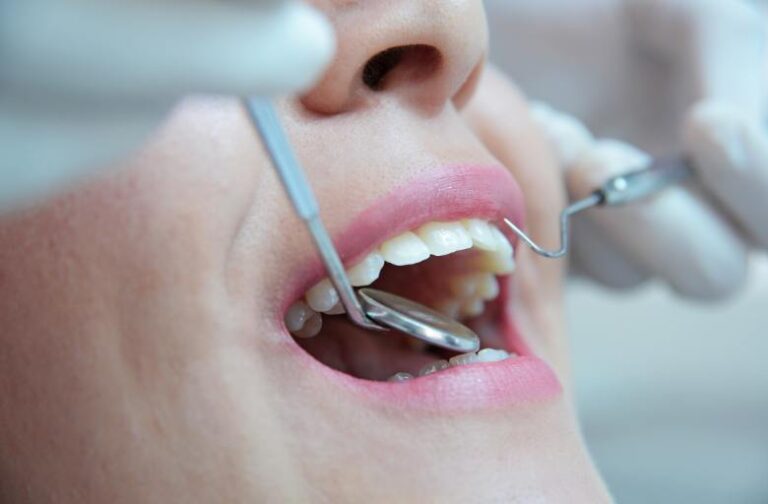 Preguntas frecuentes sobre una endodoncia.